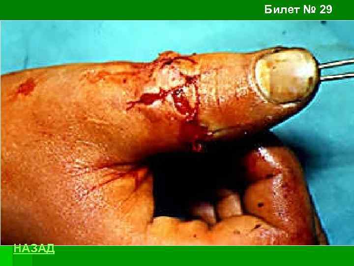 Билет № 29 НАЗАД 