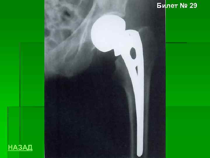 Билет № 29 НАЗАД 