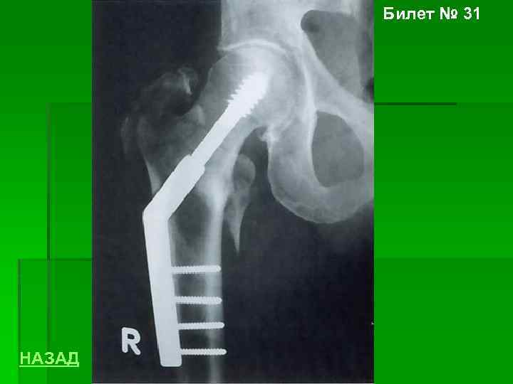Билет № 31 НАЗАД 