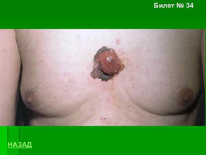 Билет № 34 НАЗАД 