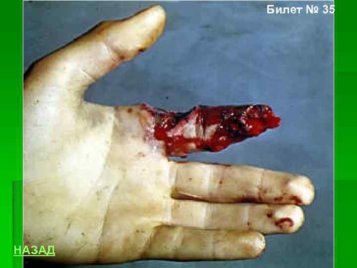 Билет № 35 НАЗАД 