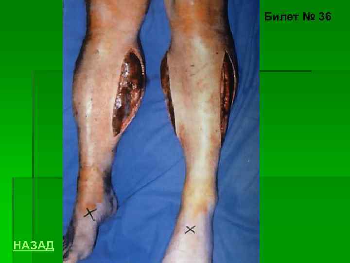 Билет № 36 НАЗАД 