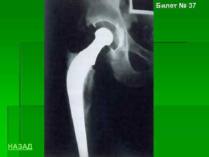 Билет № 37 НАЗАД 