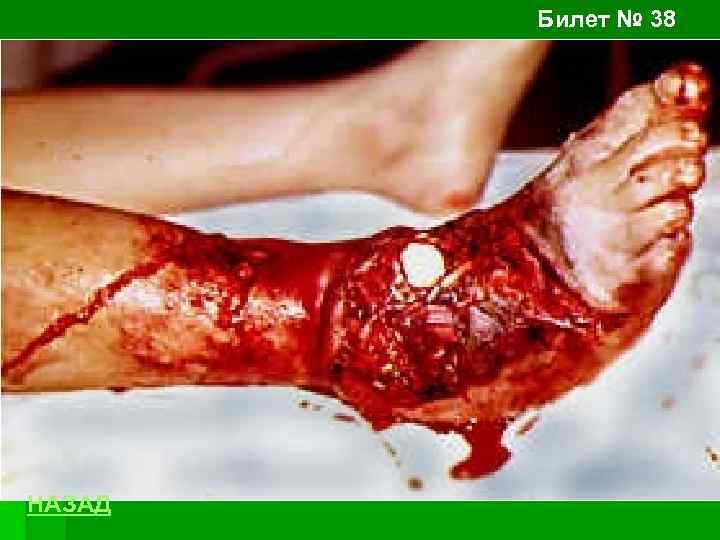 Билет № 38 НАЗАД 