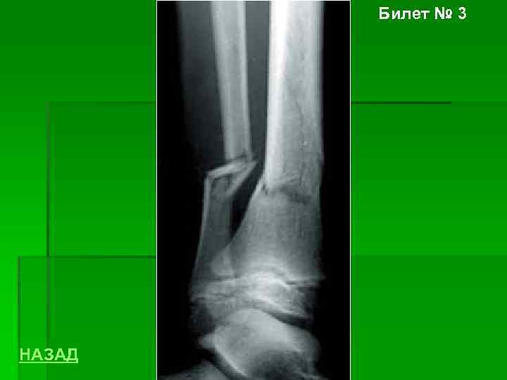 Билет № 3 НАЗАД 
