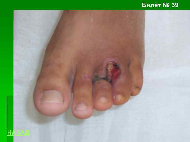 Билет № 39 НАЗАД 