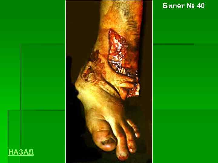 Билет № 40 НАЗАД 