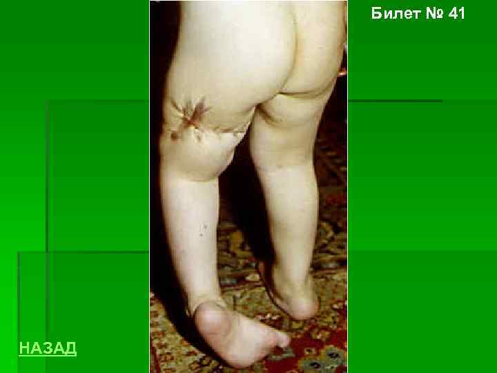 Билет № 41 НАЗАД 
