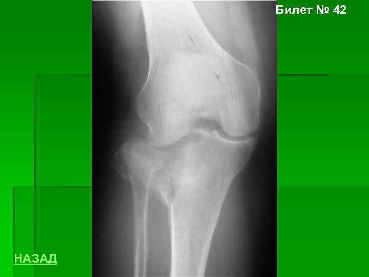 Билет № 42 НАЗАД 