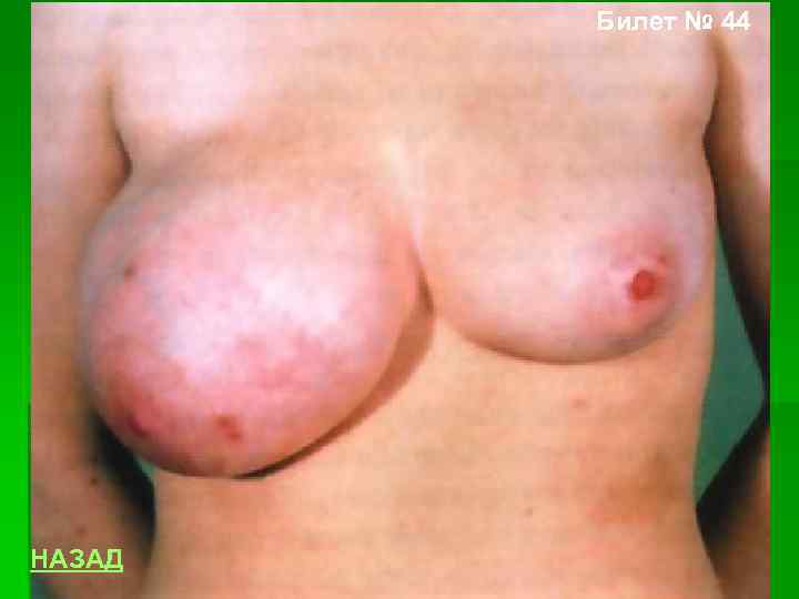 Билет № 44 НАЗАД 
