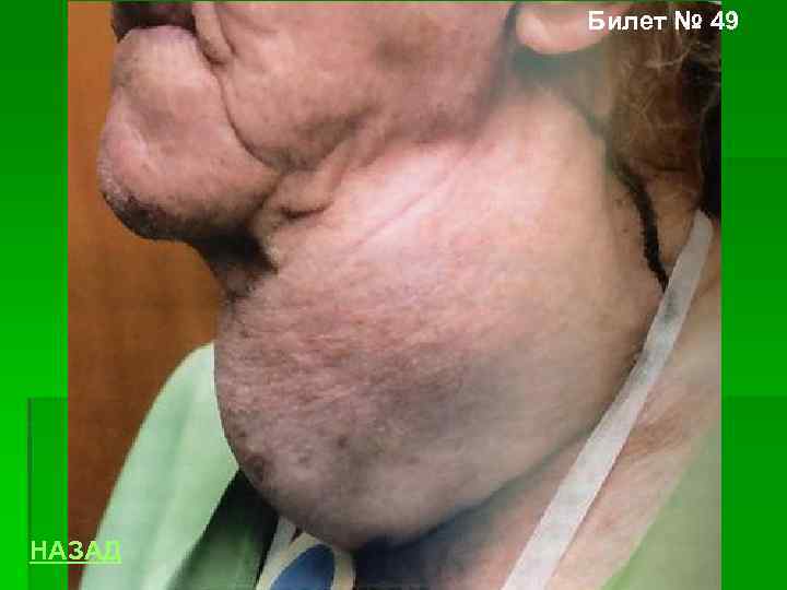 Билет № 49 НАЗАД 
