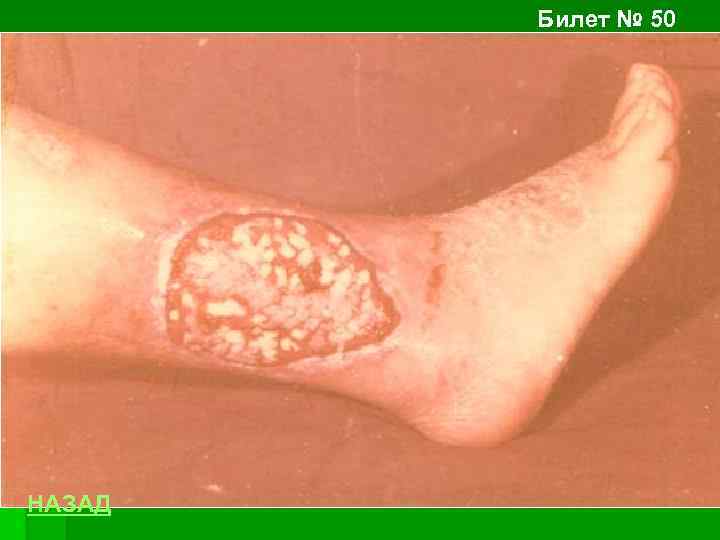 Билет № 50 НАЗАД 