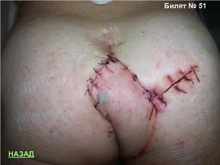 Билет № 51 НАЗАД 
