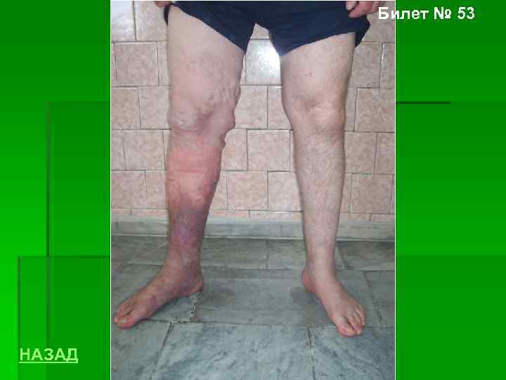 Билет № 53 НАЗАД 