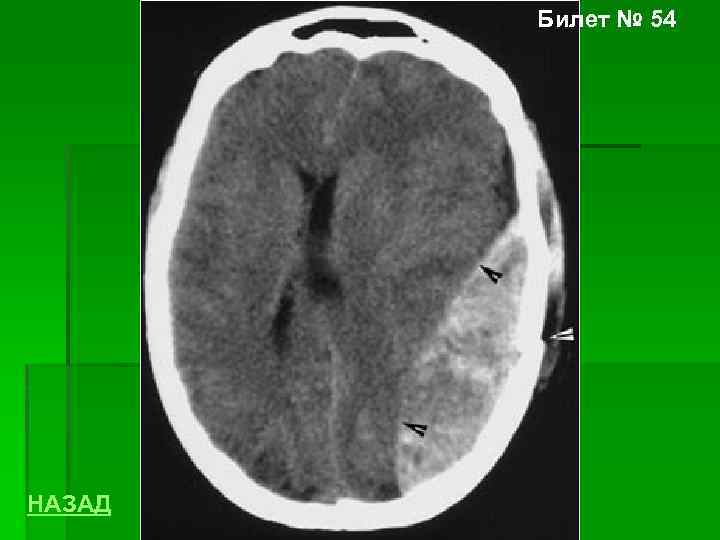 Билет № 54 НАЗАД 