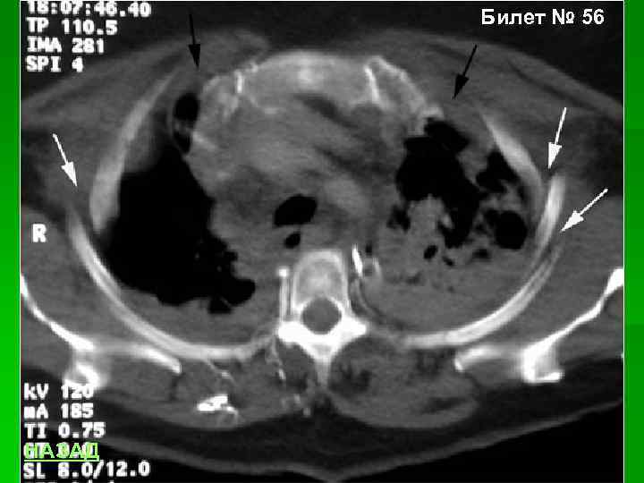 Билет № 56 НАЗАД 
