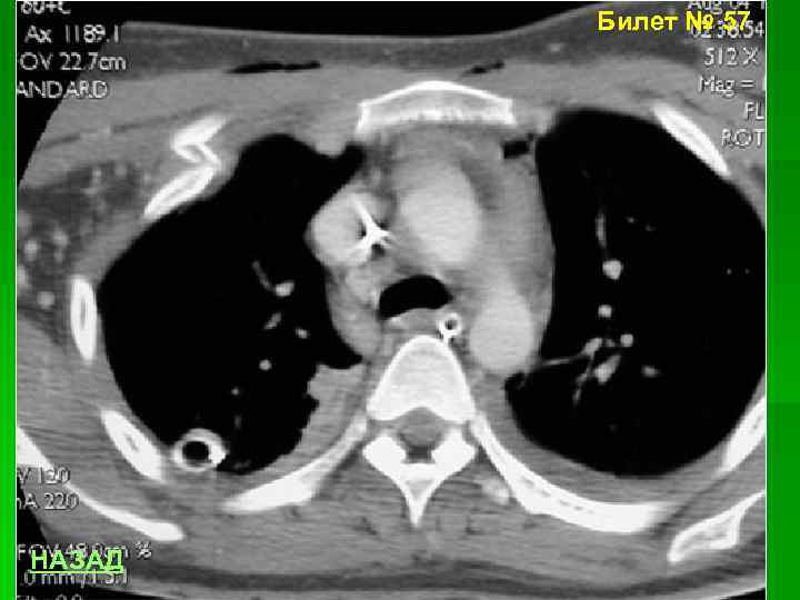 Билет № 57 НАЗАД 