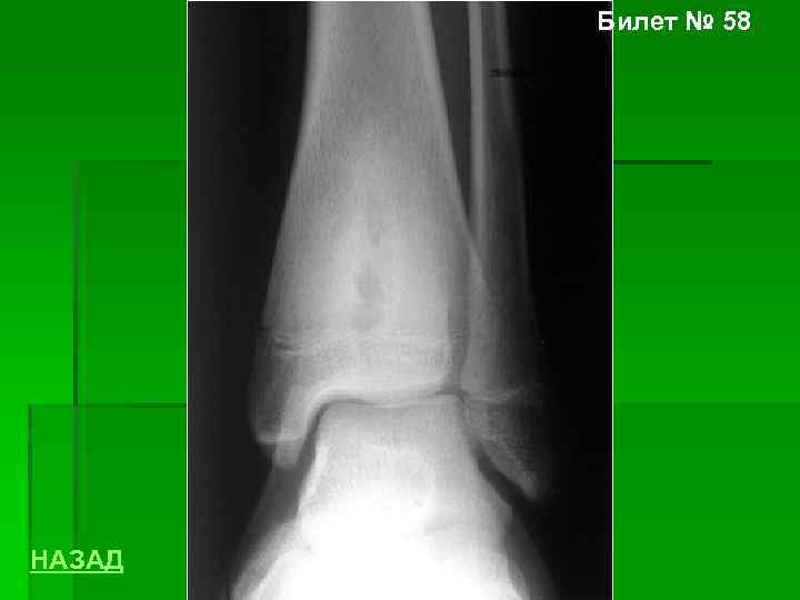 Билет № 58 НАЗАД 