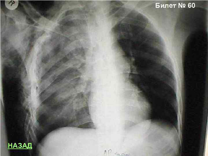 Билет № 60 НАЗАД 