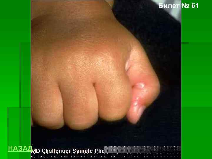 Билет № 61 НАЗАД 