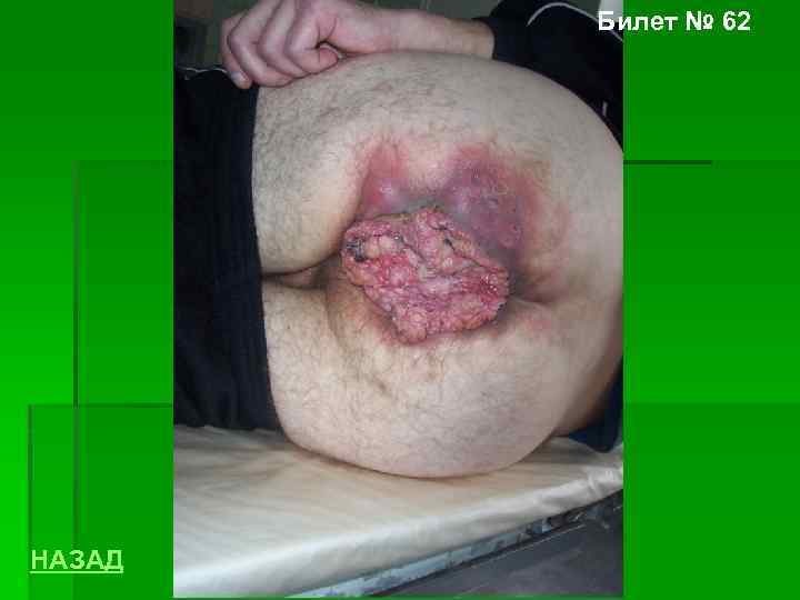 Билет № 62 НАЗАД 