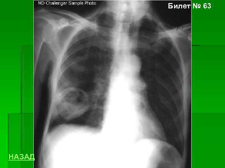 Билет № 63 НАЗАД 