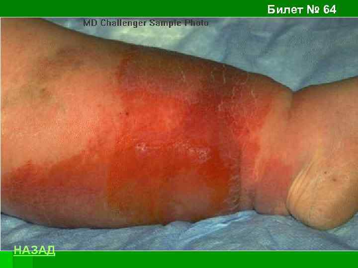 Билет № 64 НАЗАД 