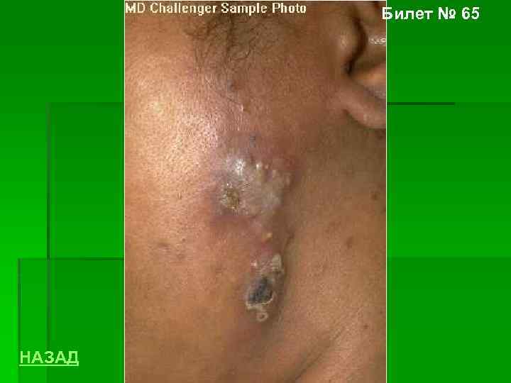 Билет № 65 НАЗАД 