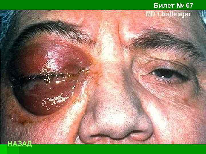 Билет № 67 НАЗАД 