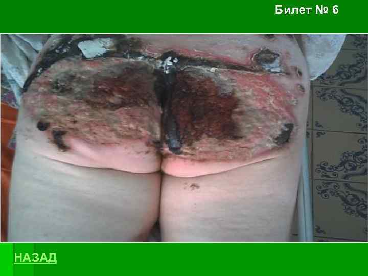 Билет № 6 НАЗАД 