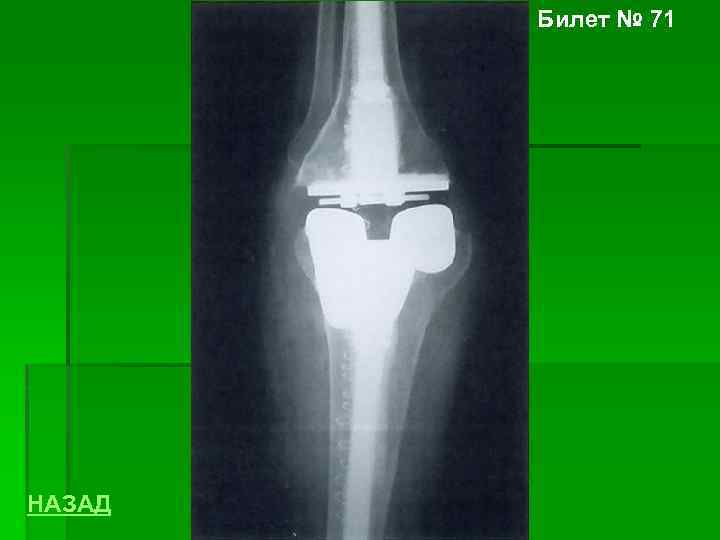 Билет № 71 НАЗАД 