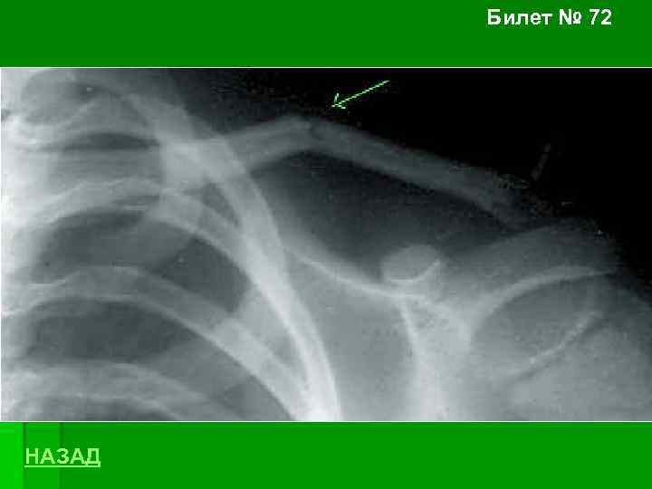 Билет № 72 НАЗАД 