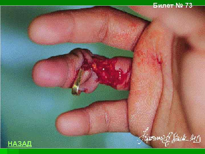 Билет № 73 НАЗАД 