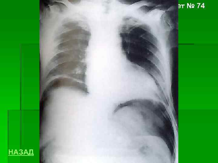 Билет № 74 НАЗАД 