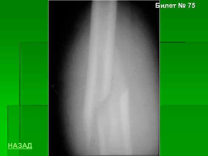 Билет № 75 НАЗАД 