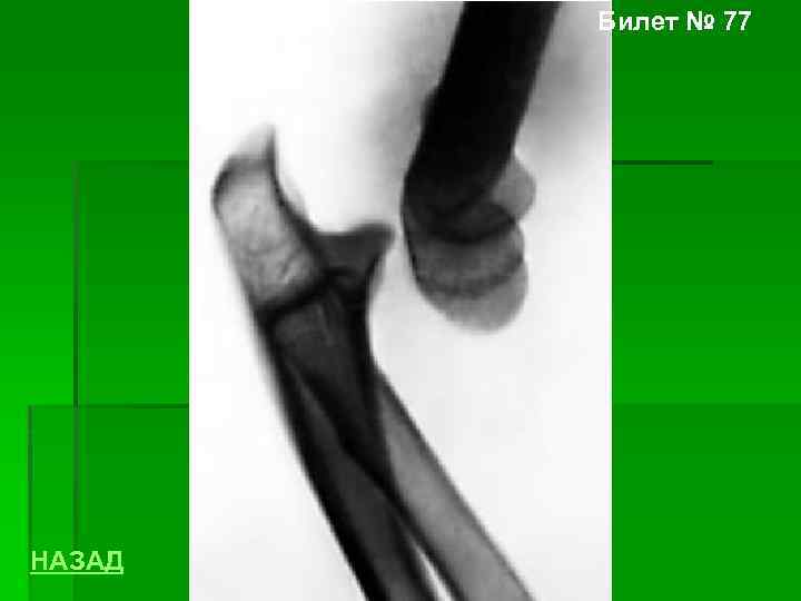 Билет № 77 НАЗАД 