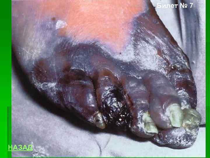 Билет № 7 НАЗАД 