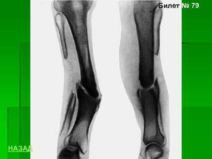 Билет № 79 НАЗАД 