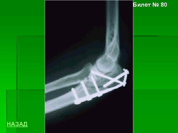 Билет № 80 НАЗАД 
