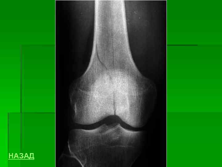 НАЗАД 