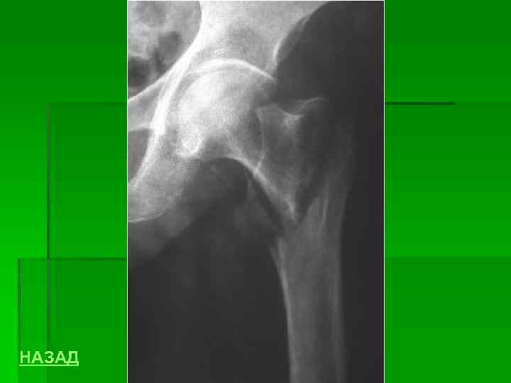 НАЗАД 