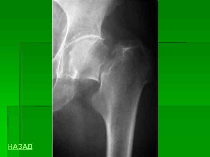 НАЗАД 
