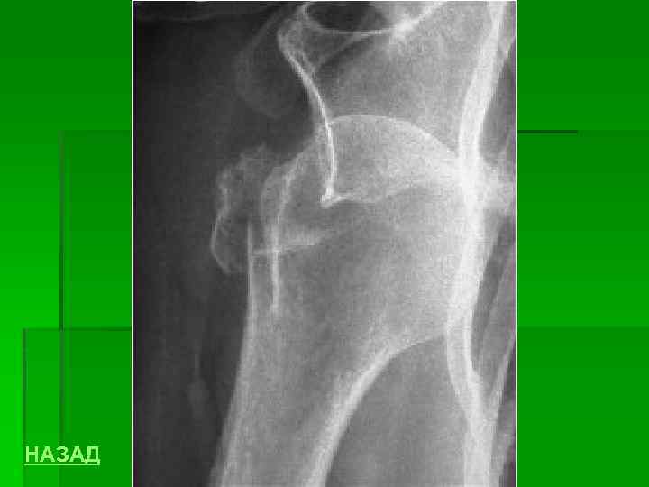 НАЗАД 