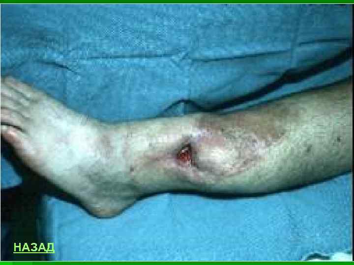 НАЗАД 