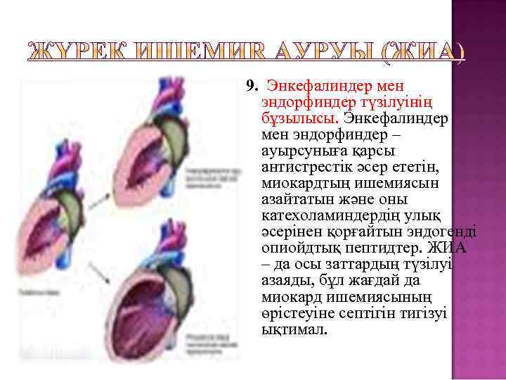 9. Энкефалиндер мен эндорфиндер түзілуінің бұзылысы. Энкефалиндер мен эндорфиндер – ауырсуныға қарсы антистрестік әсер