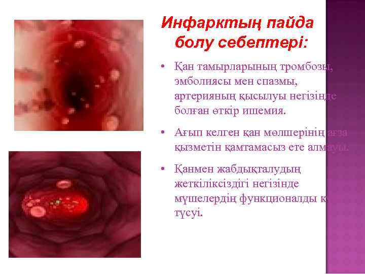 Инфарктың пайда болу себептері: • Қан тамырларының тромбозы, эмболиясы мен спазмы, артерияның қысылуы негізінде