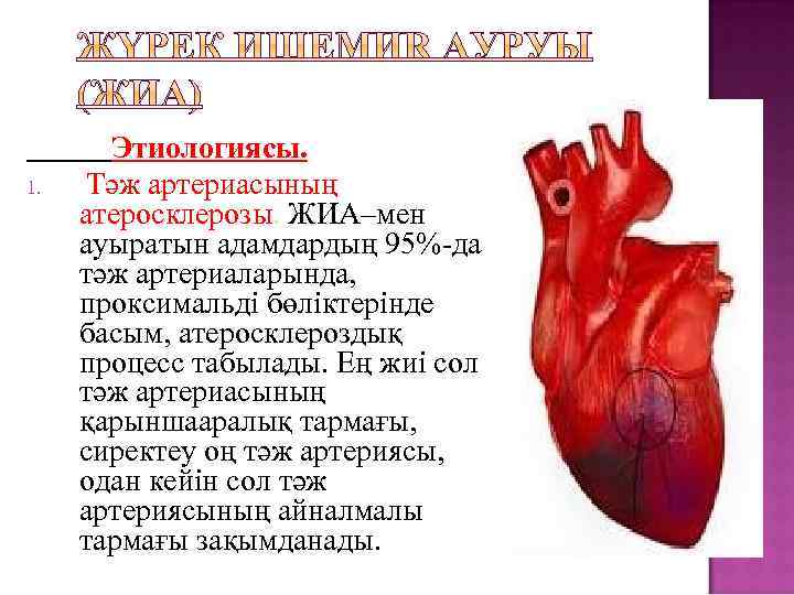 1. Этиологиясы. Тәж артериасының атеросклерозы. ЖИА–мен ауыратын адамдардың 95%-да тәж артериаларында, проксимальді бөліктерінде басым,