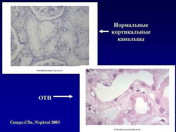 Нормальные кортикальные канальцы ОТН Compr. Clin. Nephrol 2003 