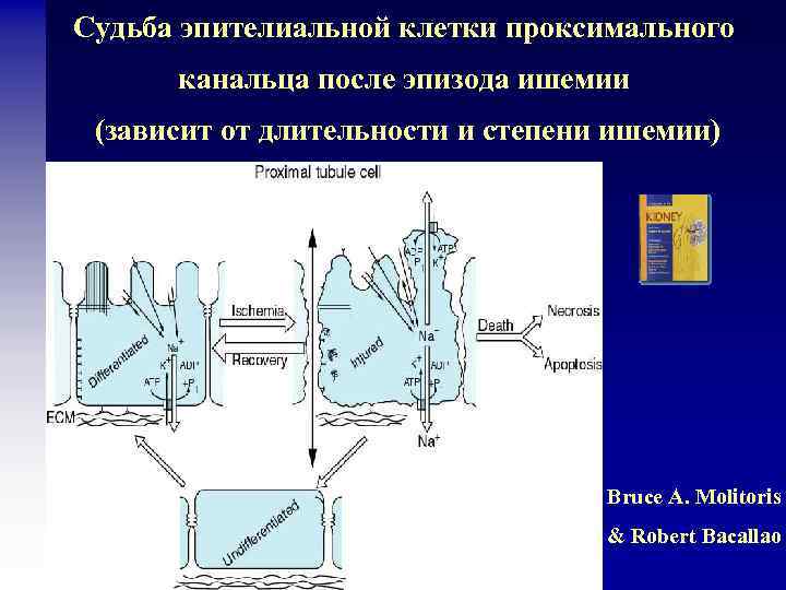 Судьба эпителиальной клетки проксимального канальца после эпизода ишемии (зависит от длительности и степени ишемии)