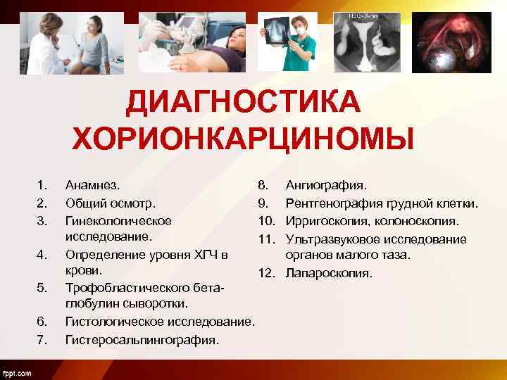 ДИАГНОСТИКА ХОРИОНКАРЦИНОМЫ 1. 2. 3. 4. 5. 6. 7. 8. Анамнез. Общий осмотр. 9.